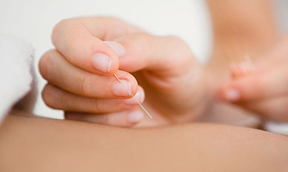 chiropractor in Singapore