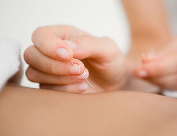 chiropractor in Singapore