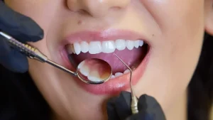 Revealing the Science Behind Orthodontic Transformation