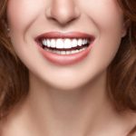 Veneers: Crafting Timeless Smiles with Artistic Precision