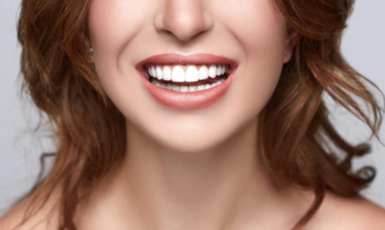 Veneers: Crafting Timeless Smiles with Artistic Precision